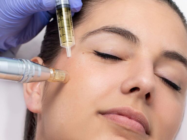 Client receiving LED microneedling therapy with serum infusion to improve skin tone and texture.